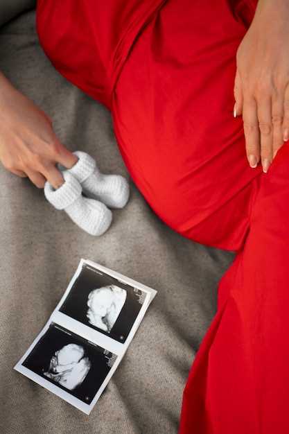 Как определить наличие гипоксии по данным КТГ